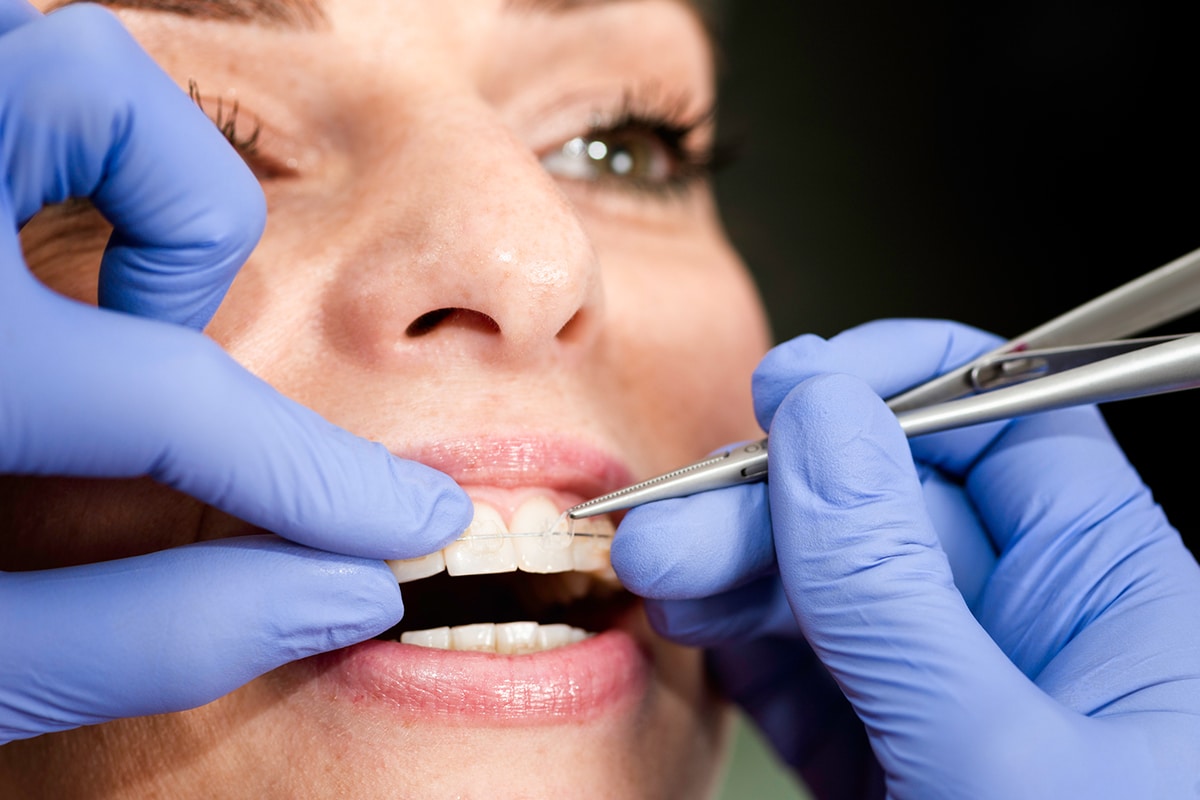 Does Medicaid Cover Braces For Children In Florida What Miami Parents Should Know Blog